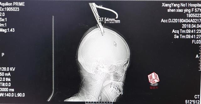 弱点漫画在线观看