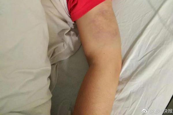 缘之空借兄妹情纠葛引发思索,为何对兄妹恋情描绘引争议?