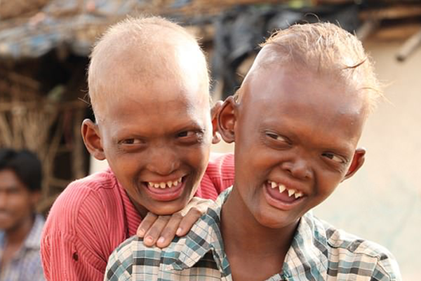 弱点漫画在线观看