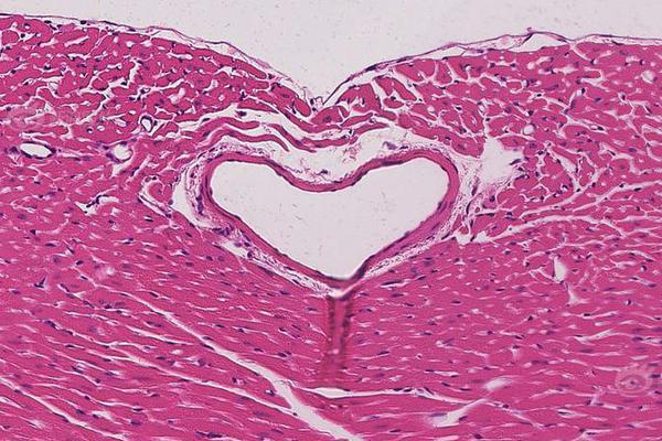 缘之空借兄妹情纠葛引发思索，为何对兄妹恋情描绘引争议？