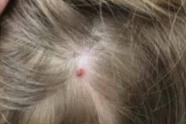 《海贼王第890集》在线观看