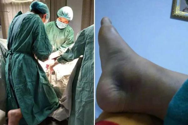 铁姬钢兵漫画古风免费