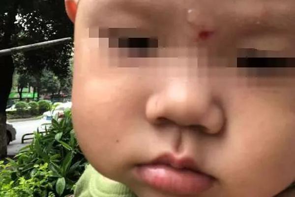 数字阅读普及下，韩漫免费观看的凯发k8国际首页登录的版权风险与安全提示